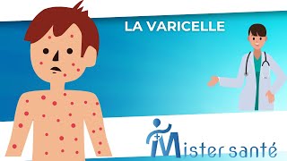 Que faire si mon enfant a la varicelle [upl. by Hgielrac]