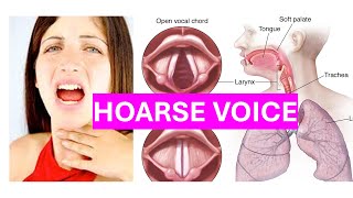 Hoarse Voice খোন শিবা [upl. by Norbie]