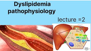 Pathophysiology of hyper dyslipidemia  dyslipidemia types and causes  hypercholesteolemia [upl. by Sophi]