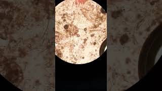 sarcoptic scabiei  sarcoptic mange canine scabies under microscope [upl. by Aneeh]