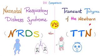 Neonatal Respirtory Distress Syndrome NRDS vs Transient Tachypnea of the Newborn TTN [upl. by Yves453]