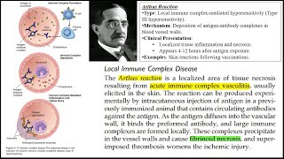 ARTHUS REACTION  PATHOLOGY PAPAER 1 RGUHS MBBS PYQs  3 Markers  Quick Review  ROBBINS [upl. by Trembly]