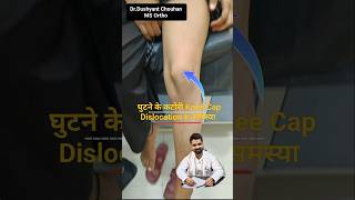 Knee Cap Patellar Dislocation Problem 💥 Katori khisak jati hai recurrentpatelladislocation [upl. by Keyek]