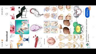 lec59 Obstratics LHV Management of Pain الٹے بچے کی صورت میں پیدائش کے دوران دردوں کو کنٹرول کرنا [upl. by Dahraf741]