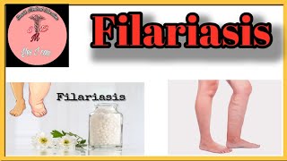 Filariasis l Causes l Sign amp Symptoms l Management [upl. by Averyl723]