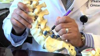 Surgical Procedures  Lumbar Laminectomy amp Discectomy [upl. by Tom]