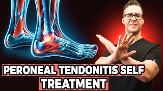 Peroneal Tendonitis Self Treatment Stretches Exercises amp Massage [upl. by Burrow]