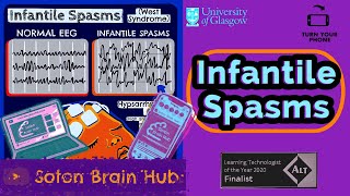 Infantile Spasms [upl. by Nnaesor]