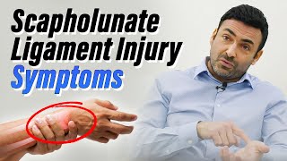 What is a scapholunate ligament injury [upl. by Schuyler]