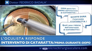 Intervento di Cataratta Cosa Succede Prima Durante e Dopo L’Oculista Risponde [upl. by Akener99]