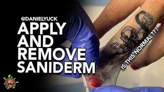 Applying And Removing Saniderm Is This Normal [upl. by Ahsima244]