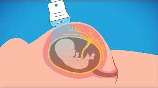 Advanced prenatal genetic testing [upl. by Chafee]