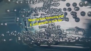 Nonlactose fermenting Escherichia coli growth on CLED Agar [upl. by Burg]