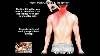 Neck Pain Causes and Treatment  Everything You Need To Know  Dr Nabil Ebraheim [upl. by Kalk]