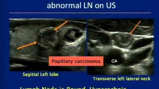 Thyroid Ultrasound Course [upl. by Hajed]