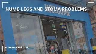 Stoma problems and numb legs [upl. by Pembroke]