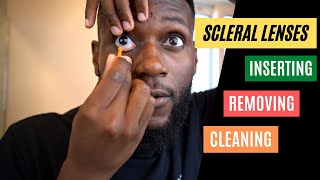 KC Hacks  Inserting Removing And Cleaning Scleral Lenses  Scleral Lenses [upl. by Randal]