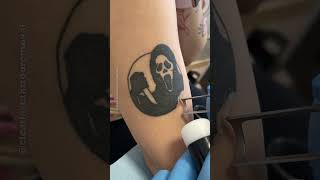 The ABSOLUTE TRUTH About Tattoo Removal Pain Revealed [upl. by Kinchen932]