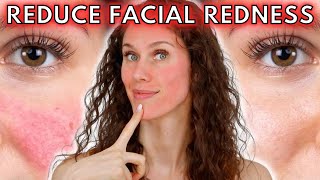 🔴 5 Reasons Your Face Is Always Red Rosacea to Dermatographia amp Everything Inbetween [upl. by Drue]