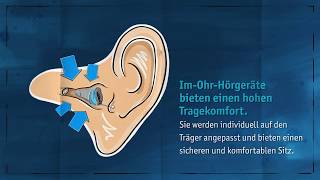 ImOhrHörgeräte einfach erklärt [upl. by Aisaim]