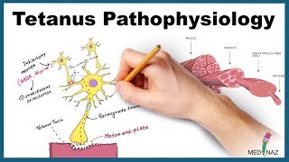 Tetanus Pathophysiology Mechanism of Action [upl. by Herald]