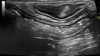 Sonography of ulcerative or granulomatous colitis in a French Bulldog [upl. by Zurkow]