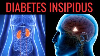 What is Diabetes Insipidus Symptoms Causes Treatment [upl. by Costanza508]