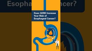 Does GERD Increase Your Risk of Esophageal Cancer [upl. by Ennairb]