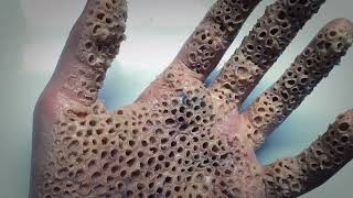 Trypophobia Test  Do you have a fear of small holes [upl. by Cartie]