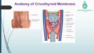 Cricothyroidotomy [upl. by Enaxor511]