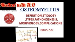 osteomyelitis in hindi DEFINITION ETIOLOGY pathogenesis morphology complications types etc [upl. by Eelymmij768]