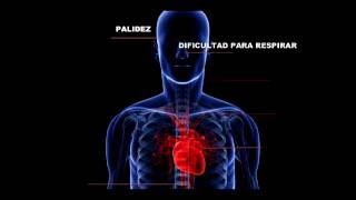 SINTOMAS DE INFARTO AL CORAZON [upl. by Wichern]