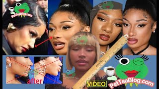 Nicki Minaj SUBS Megan Thee Stallion for Getting a Replica Nose Job Copying her Natural Born Nose👃🏻 [upl. by Pedaias]