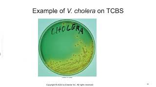 Vibrio Aeromonas and Campylobacter [upl. by Nelg213]