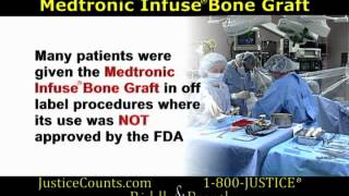 Medtronic Infuse® Bone Graft [upl. by Eloci]