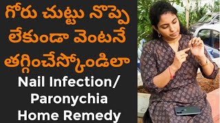 గోరు చుట్టుGoru Chuttu Home RemedyNail Infection treatment at homeParonychiaBest Remedy telugu [upl. by Imugem12]