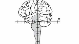 NeuroLogic Exam Videos  quotyquot Values [upl. by Lauretta]