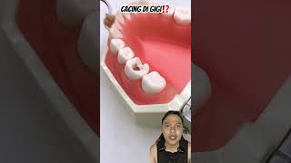 CACING DI GIGI⁉️ dentist teethshield diy healthyteeth satisfying handmade art music anime [upl. by Anilesor]