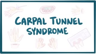 Carpal tunnel syndrome  causes symptoms diagnosis treatment amp pathology [upl. by Materse]