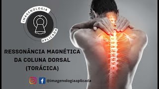 Ressonância Magnética da Coluna Dorsal Torácica [upl. by Lalita481]