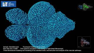 Zebrafish brain vessel quantification LIT [upl. by Ulysses617]