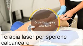 Trattamento speroni calcaneali con laser recensioni corso e controindicazioni [upl. by Rucker]