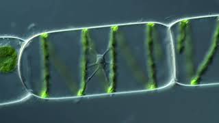 The Nucleus of Spirogyra Synedra [upl. by Eiboj884]