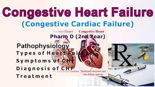 Congestive cardiac failure [upl. by Lewert]