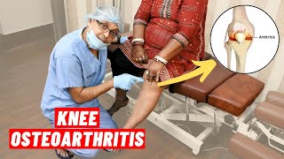 Knee Osteoarthritis Chiropractic Treatment I Dr Sanjay Sarkar USA I Call 9903026262 [upl. by Dicks]