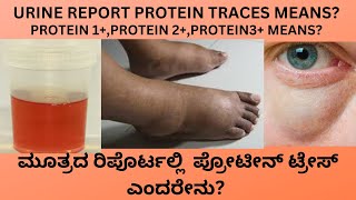 PROTEIN PRESENTTRACES IN URINE CAUSES SYMPTOMS AND TREATMENT OF PROTEIN IN URINE IN KANNADA [upl. by Shaw]