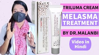 Melasma का इलाज Triluma cream के फ़ायदे Melasma के लिए Dr Malanbi [upl. by Ennavoj]