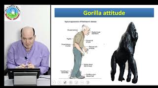 Basal ganglia disorders  Parkinsonism Parkinson disease  Chorea  Athetosis  Ballismus [upl. by Edouard]