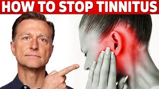 How to Stop Tinnitus ringing in the ears – Try DrBergs Home Remedy to Get Rid of It [upl. by Maurene607]