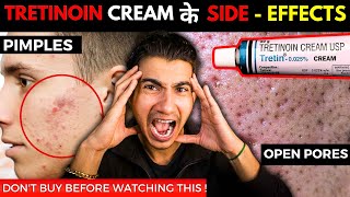 How to Apply Tretinoin Cream I Tretinoin Journey I Tretinoin Side Effects [upl. by Latyrc]